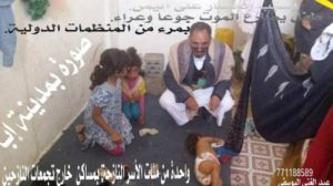 يوميات حرب اليمن ..نداء لاصحاب الضمير ، و "مغترب" يكتب لوالدته التى فقدها فى الحصار
