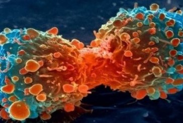 اكتشاف أجسام مضادة قادرة على محاربة السرطان
