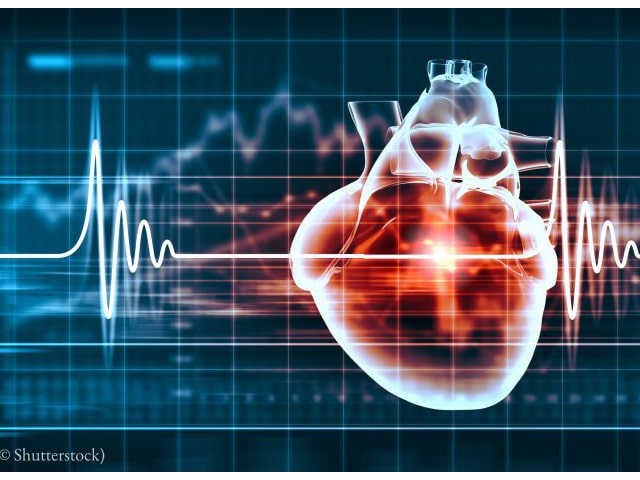 استخدام الذكاء الاصطناعي للمساعدة في مكافحة أمراض القلب